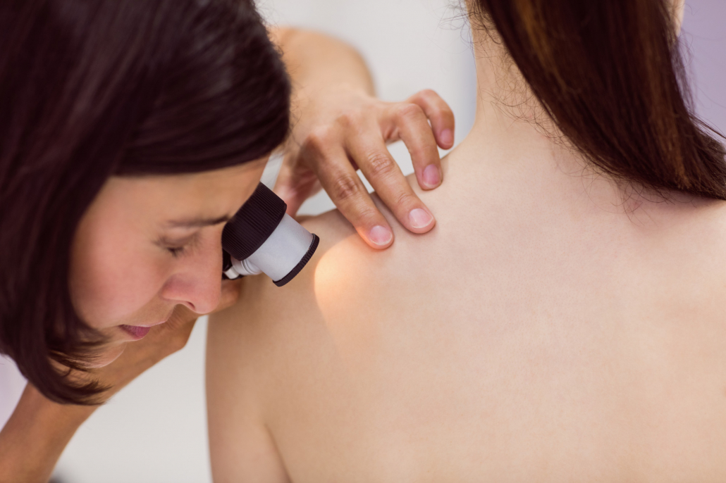 RECHERCHE GRAIN DE BEAUTÉ KARE SANTÉ